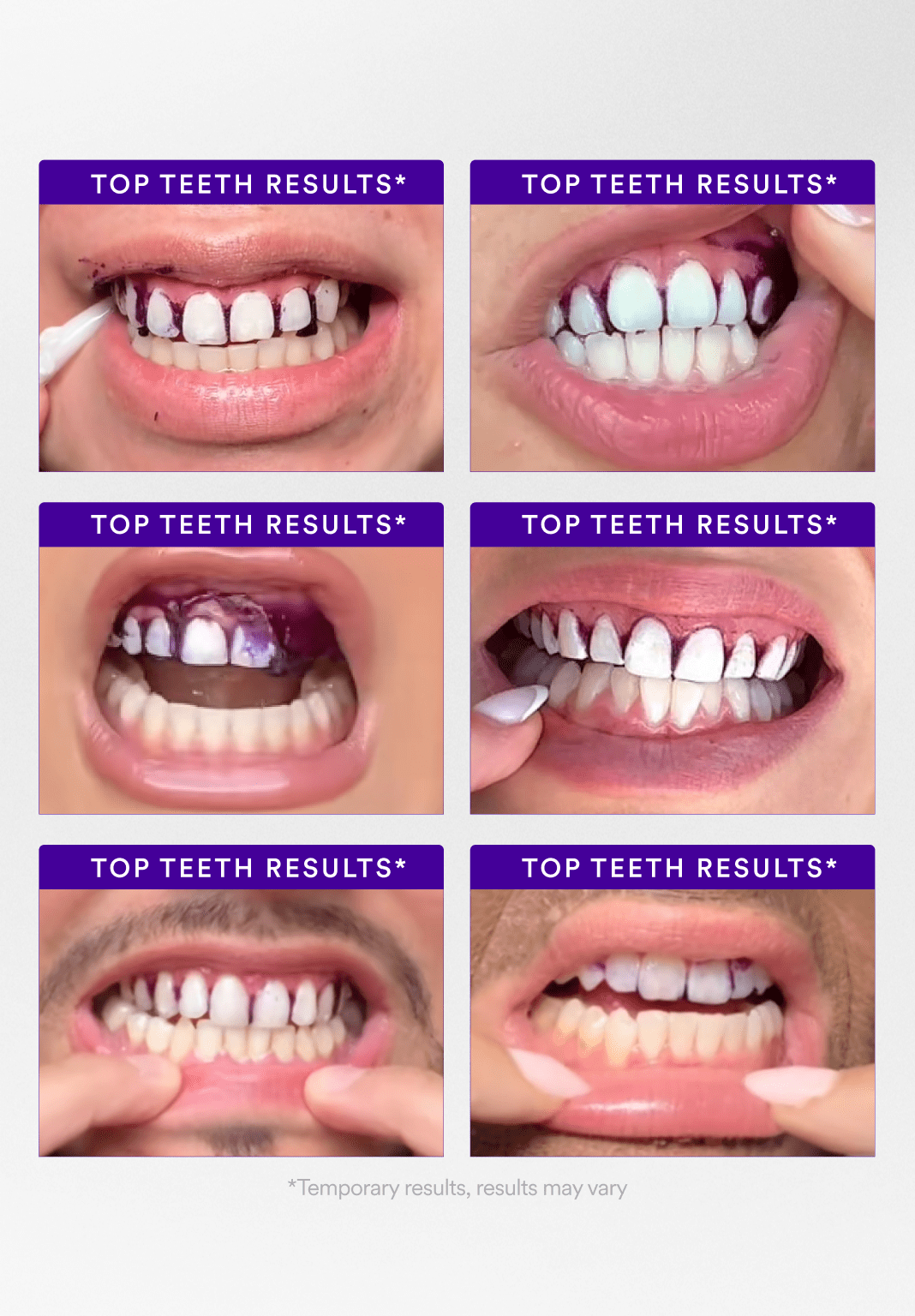 V34 Whitening Strips